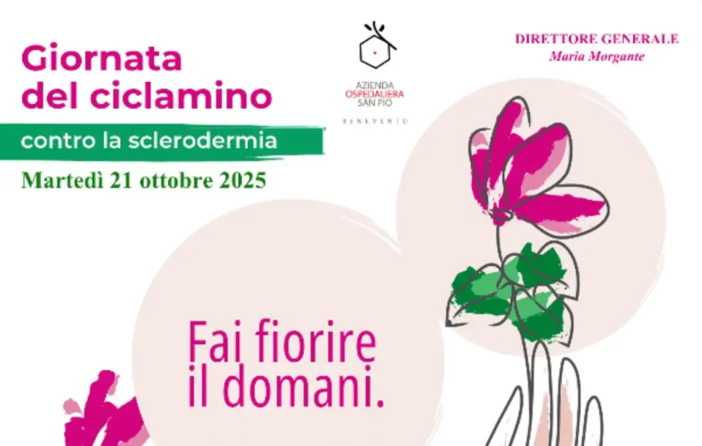 Sclerodermia San Pio Benevento