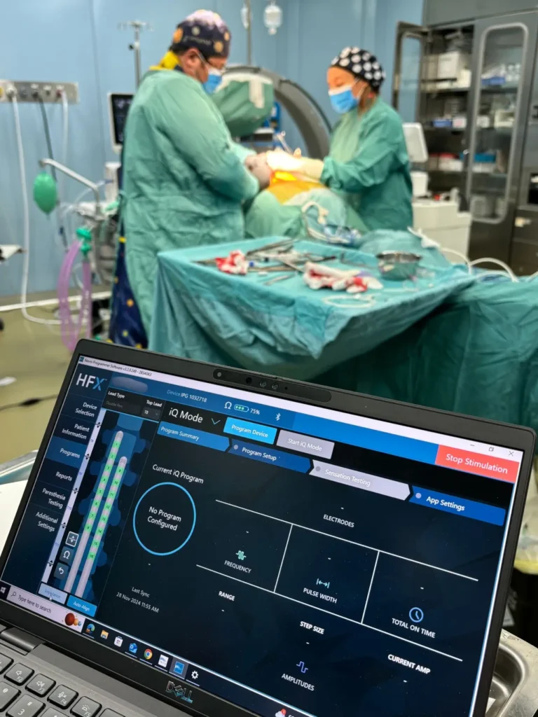 stimolazione midollare con intelligenza artificiale