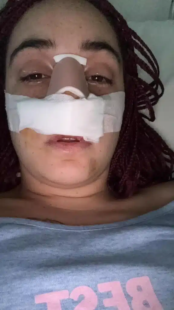 violenza domestica Brusciano